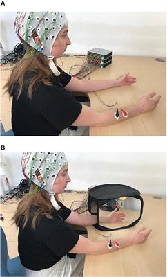 Cortical Functional Domains Show Distinctive Oscillatory Dynamic in Bimanual and Mirror Visual Feedback Tasks